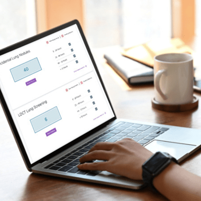 wish-allocation-technology_400x372